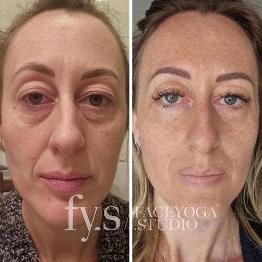 Face Yoga Avant Apres Resultats